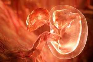foto 4D de un útero con embrión